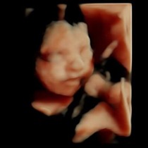 June 2015 - bumps ahoy!