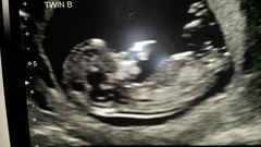 Gender guess anyone?