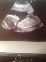 Boy or girl finding out wednesday