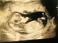 12 weeks + 4 days nub theory