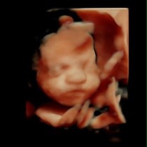 June 2015 - bumps ahoy!