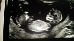 Gender guess anyone?