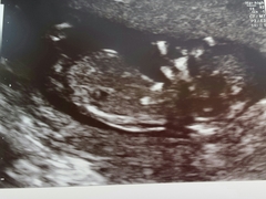 September 2015 (Thread 5) Bring on the scans! :)