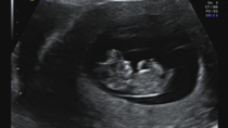 October baby bus take 3- booking in appointments and scans, here we come!