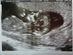 September 2015 (Thread 5) Bring on the scans! :)