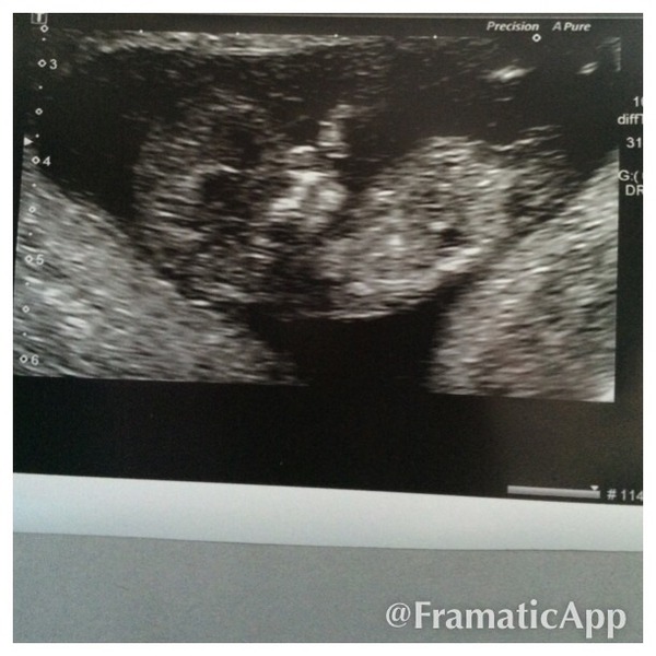 The November 2015 bus is back on the road, chugging through beautiful scan pic landscapes, picking up plenty of Dairyleas, muffins and whathaveyous on it's way!