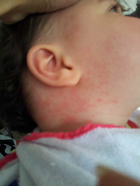 What is this on my baby's face/neck (pic added)