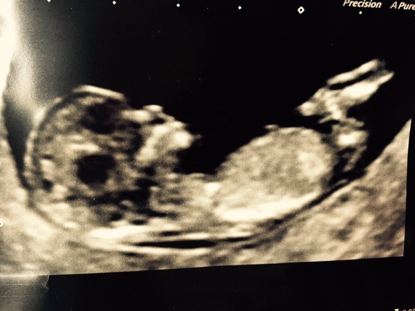 Any sex guesses please?