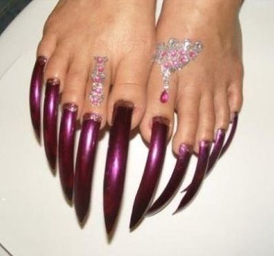 Surely you couldn't get your shoe on?