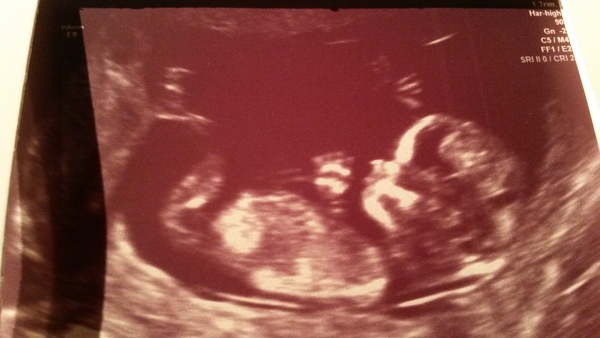 We're posifrickintive! Another posifrickintivity thread for pregnancy after miscarriage #3