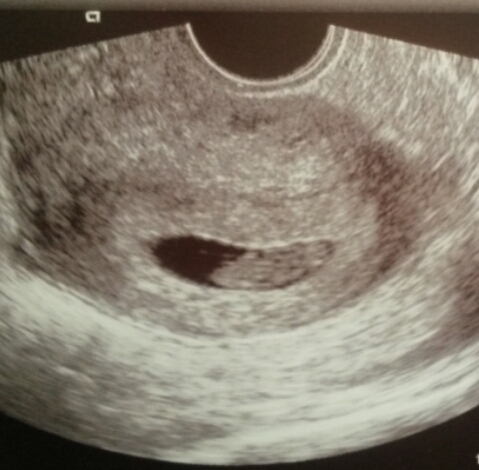 The November 2015 bus is back on the road, chugging through beautiful scan pic landscapes, picking up plenty of Dairyleas, muffins and whathaveyous on it's way!