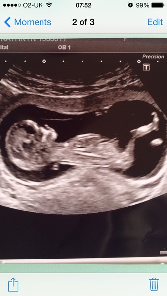 October baby bus take 3- booking in appointments and scans, here we come!