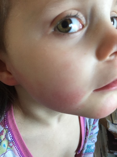 What could this rash be