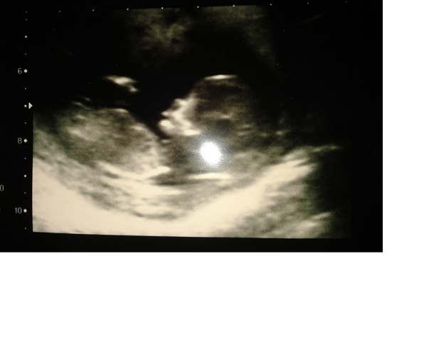 The November 2015 bus is back on the road, chugging through beautiful scan pic landscapes, picking up plenty of Dairyleas, muffins and whathaveyous on it's way!