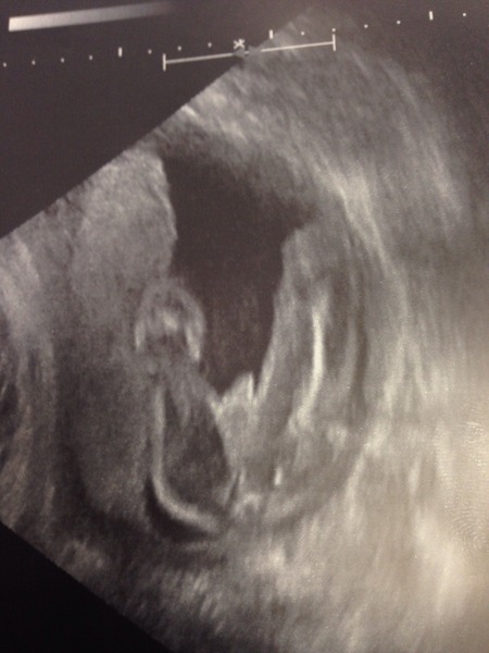 Can anyone tell me gender?