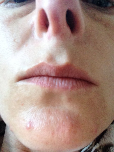 Help sort my skin (pics included)