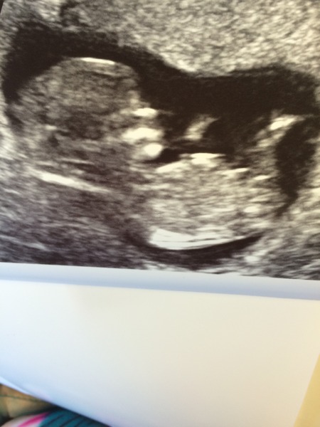 The November 2015 bus is back on the road, chugging through beautiful scan pic landscapes, picking up plenty of Dairyleas, muffins and whathaveyous on it's way!