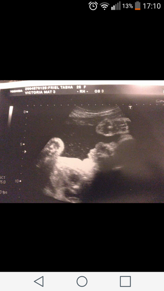 scan photo