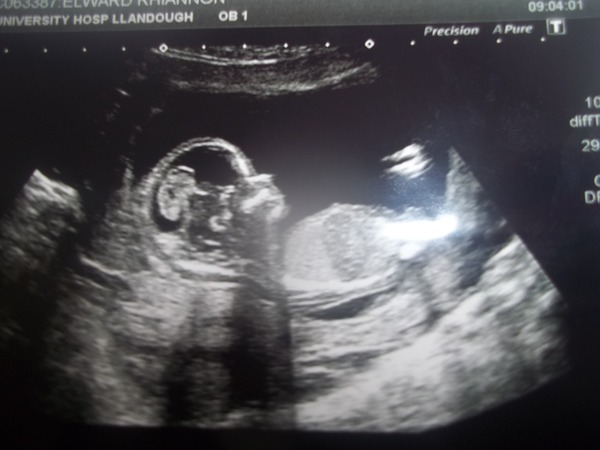 Our super healthy fanjos just love getting their five a day but we draw the line at frozen poopsicles. We're the 25th JS Grads!