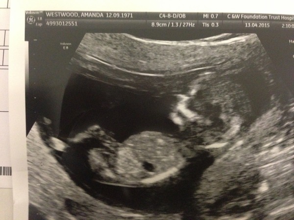 Puking our way through the first trimester: It's the November 2015 ladies here! Hand out plenty of ginger tea, cold drinks and some lovely scan pics soon!