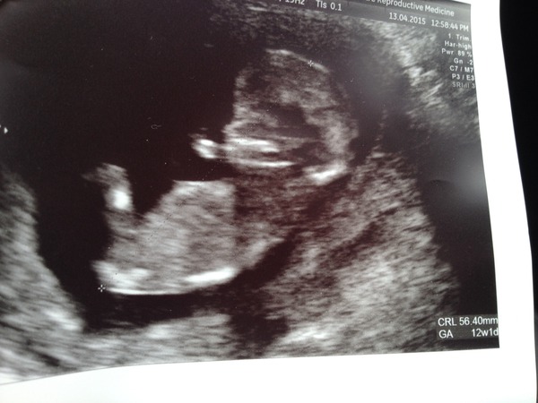 Beautiful toddlers growing into gorgeous little people (and a new baby!!), who are the apples of our eyes :)