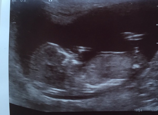 The November 2015 bus is back on the road, chugging through beautiful scan pic landscapes, picking up plenty of Dairyleas, muffins and whathaveyous on it's way!