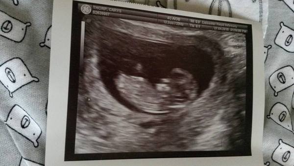 November 2015 mums to be! Here we are! Our bus is decorated with scan pics, our appetites are beginning to heal, and spring is in the air!