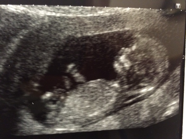 The November 2015 bus is back on the road, chugging through beautiful scan pic landscapes, picking up plenty of Dairyleas, muffins and whathaveyous on it's way!