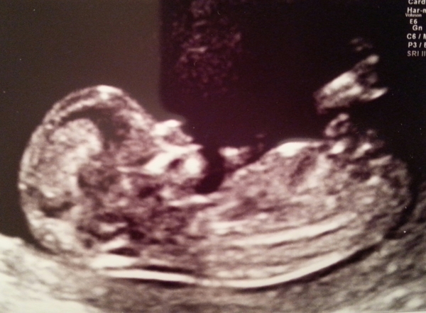 October baby bus take 3- booking in appointments and scans, here we come!