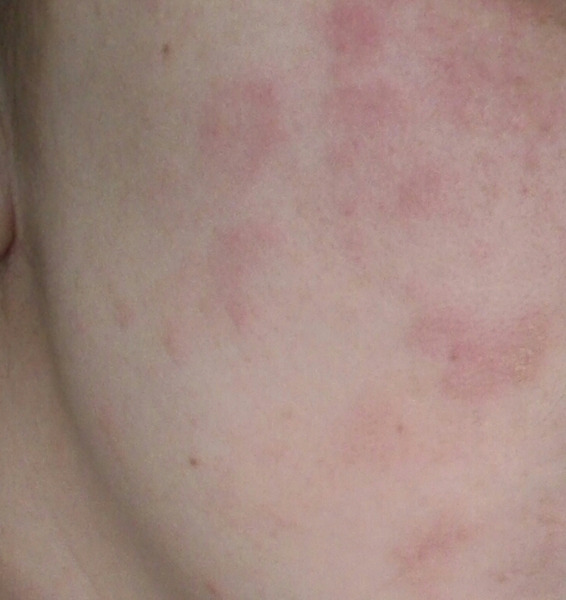 scaly skin looking skin