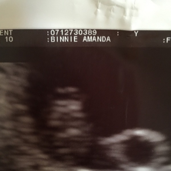 Grab your scans ladies for the...drumroll...Ramzi Placenta Theory!