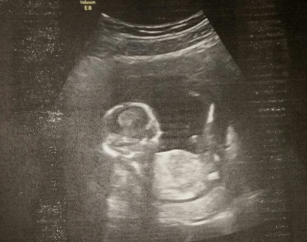 October baby bus take 3- booking in appointments and scans, here we come!