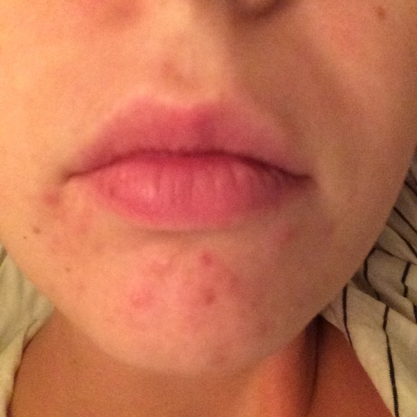 Help sort my skin (pics included)