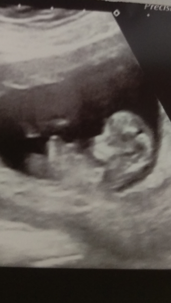 The November 2015 bus is back on the road, chugging through beautiful scan pic landscapes, picking up plenty of Dairyleas, muffins and whathaveyous on it's way!