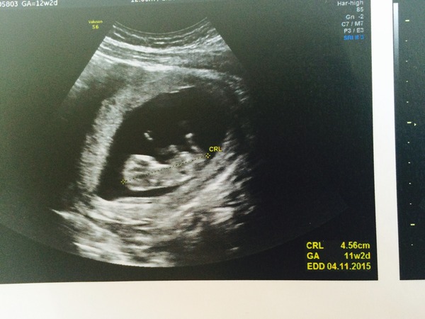 The November 2015 bus is back on the road, chugging through beautiful scan pic landscapes, picking up plenty of Dairyleas, muffins and whathaveyous on it's way!