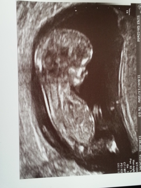 Puking our way through the first trimester: It's the November 2015 ladies here! Hand out plenty of ginger tea, cold drinks and some lovely scan pics soon!