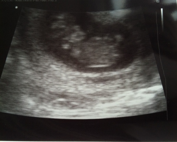 The November 2015 bus is back on the road, chugging through beautiful scan pic landscapes, picking up plenty of Dairyleas, muffins and whathaveyous on it's way!