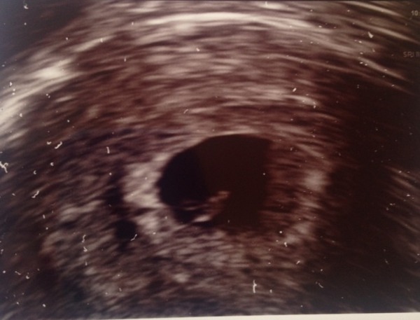 December 2015 Babies