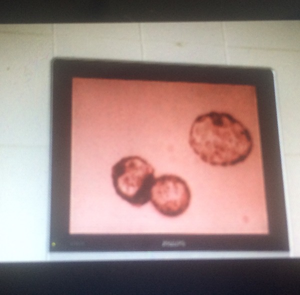 Bumsnetting Angry Pubes