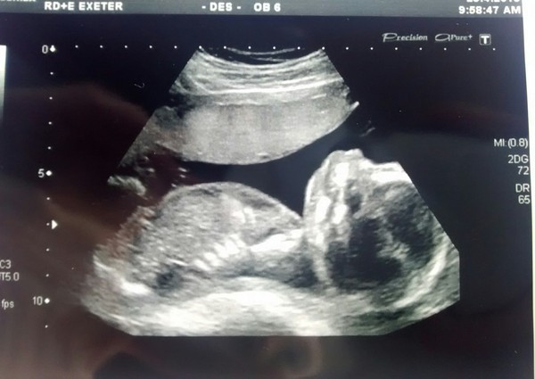 The September crew fly through to the second trimester, baby bumps galore! :) (Thread 7)