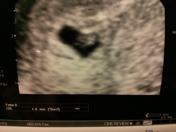 December 2015 Babies