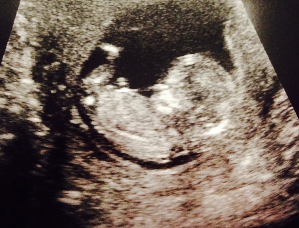 The November 2015 bus is back on the road, chugging through beautiful scan pic landscapes, picking up plenty of Dairyleas, muffins and whathaveyous on it's way!