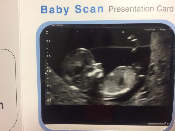 October baby bus take 3- booking in appointments and scans, here we come!