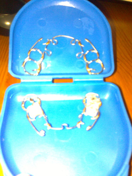 Ds 7 been referred to orthodontist