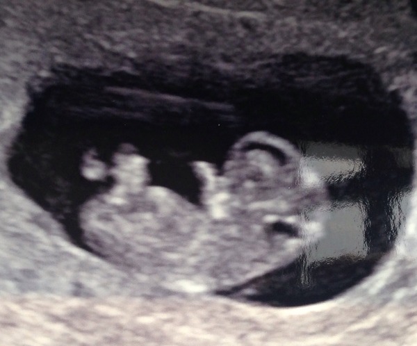 The November 2015 bus is back on the road, chugging through beautiful scan pic landscapes, picking up plenty of Dairyleas, muffins and whathaveyous on it's way!