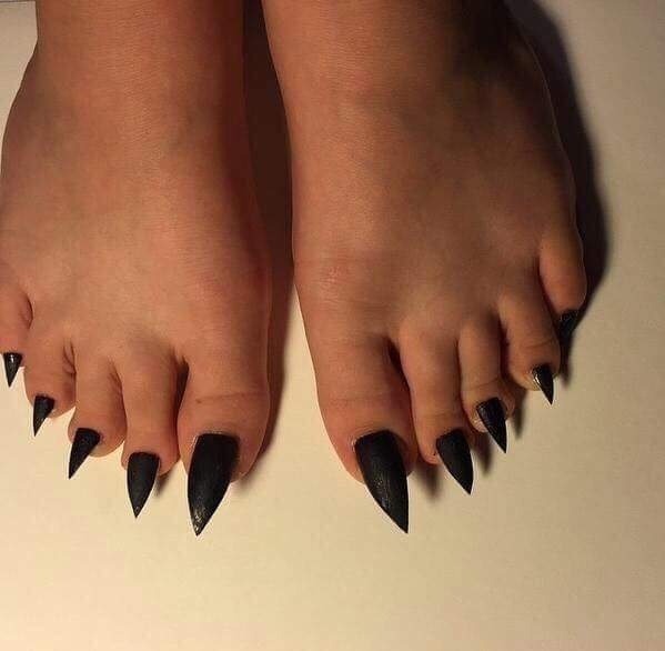 Surely you couldn't get your shoe on?