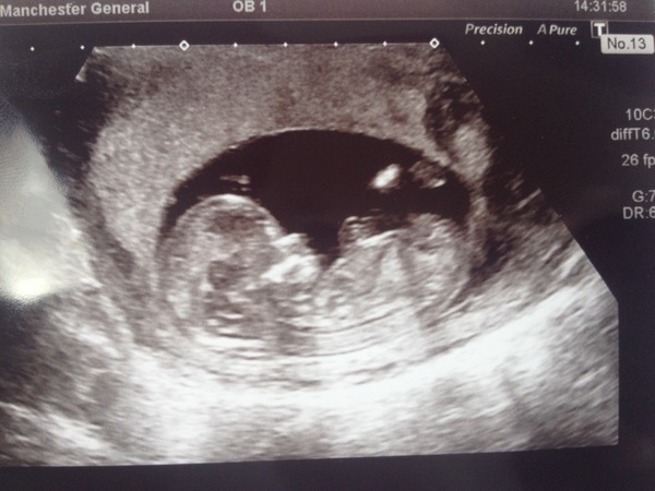 The November 2015 bus is back on the road, chugging through beautiful scan pic landscapes, picking up plenty of Dairyleas, muffins and whathaveyous on it's way!