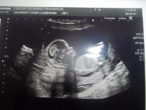 October baby bus take 3- booking in appointments and scans, here we come!