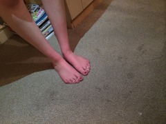 What's wrong with my toes? Any ideas would be greatly appreciated. Photos included.