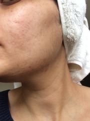 What can you tell me about my skin? (Pics included)